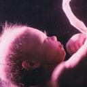 Fotografija fetusa, fotografija abdomena, ultrazvuk i video o razvoju djeteta Disproporcionalni razvoj fetusa u 26 sedmici