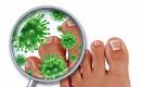 Can nail fungus spread to the skin of the feet and hands?
